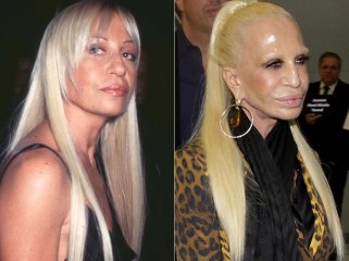 20-worst-cases-of-celebrity-plastic-surgery-gone-wrong-1